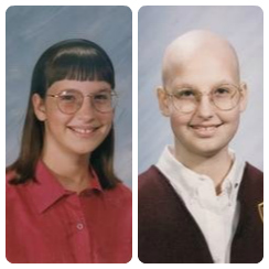 Carolyn-school-pictures-before-and-after-leukemia-treatment