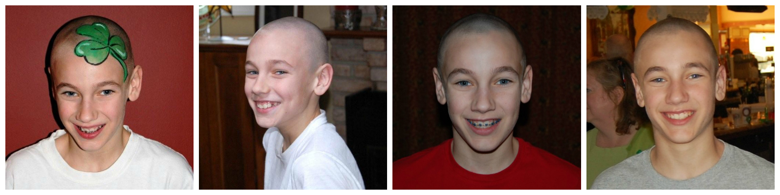 Aaron braved the shave for four years before being diagnosed with childhood cancer