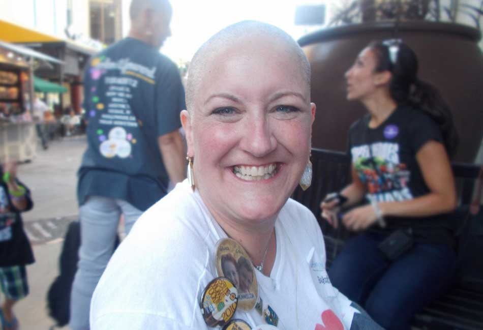 Rebekah Ham bald