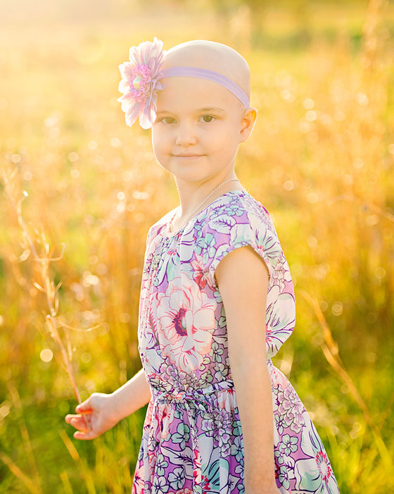 Natalie was diagnosed with leukemia last year. When she lost her hair, her family went bald with her