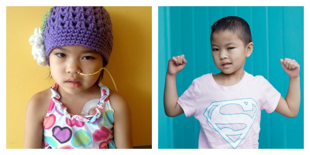 Daisy during and after treatment for medulloblastoma, a type of pediatric brain tumor