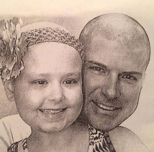 Dad with daughter bald from acute lymphoblastic leukemia treatment