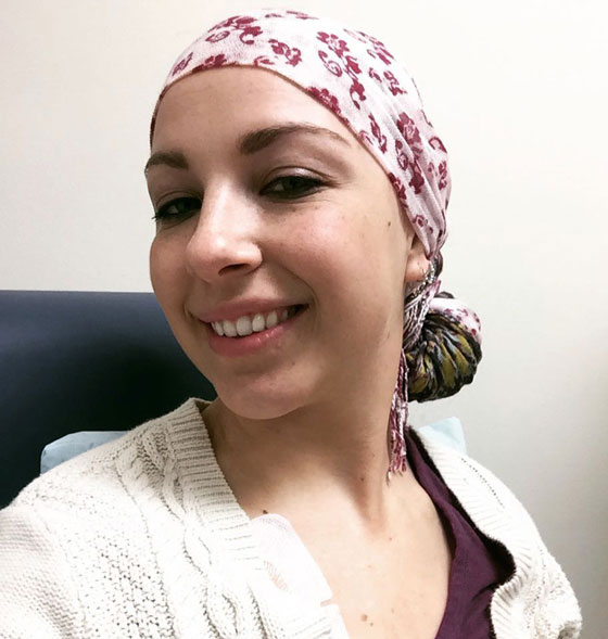 Allie wearing a scarf after losing her hair