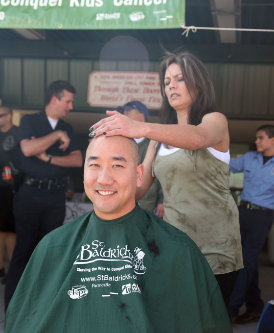 Danny Wu going bald