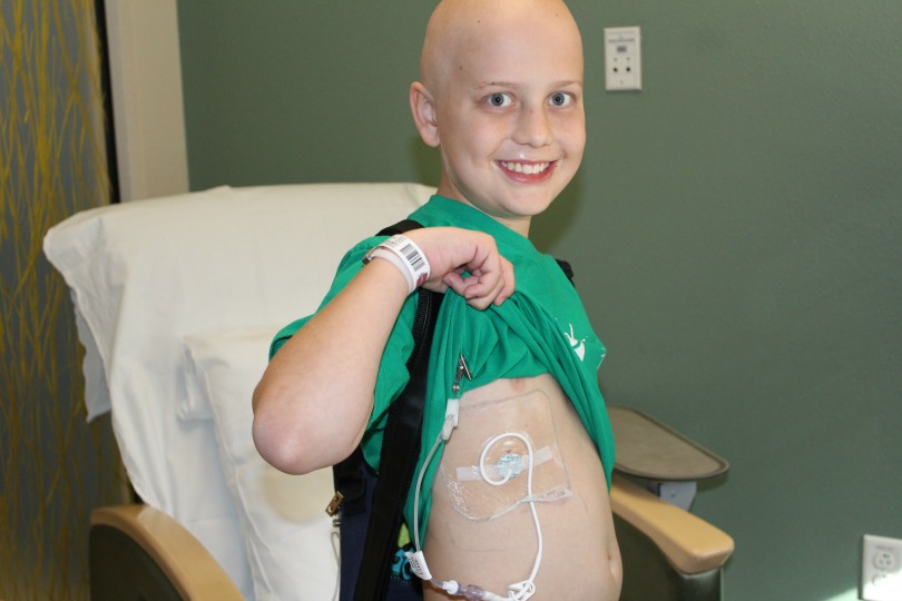 Ryan shows how the chemotherapy is infused into his body