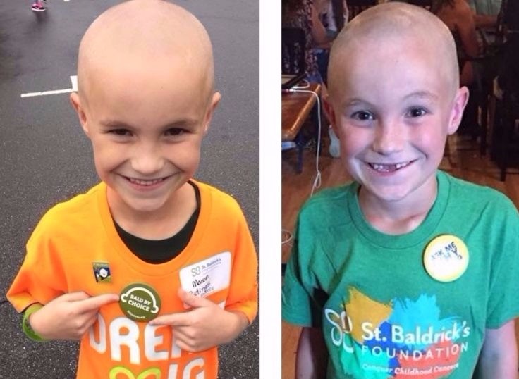 Mason during his first and second shaves for St. Baldrick's