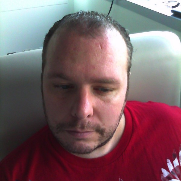 Rob Dingwell Before