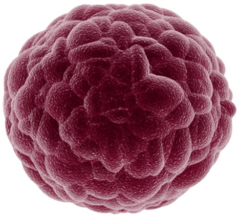 photo of a tumor